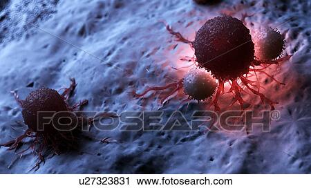Stock Image - Illustration of white blood cells attacking a cancer cell.. Fotosearch