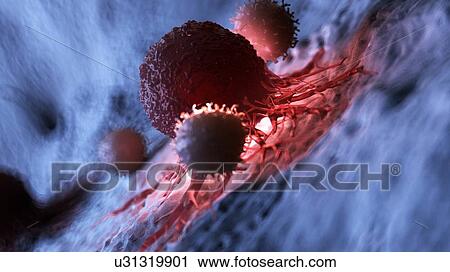 Stock Image - Illustration of white blood cells attacking a cancer cell.. Fotosearch