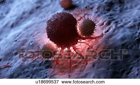 Stock Photo - Illustration of white blood cells attacking a cancer cell.. Fotosearch