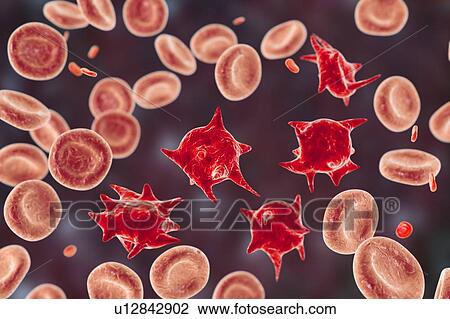 Acanthocyte abnormal red blood cells, illustration View Large Photo Image Stock Image - Acanthocyte abnormal red blood cells, illustration. Fotosearch