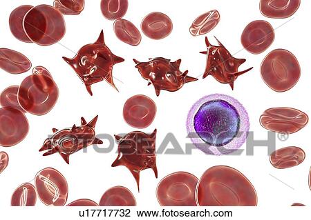 Stock Image - Acanthocyte abnormal red blood cells, illustration. Fotosearch