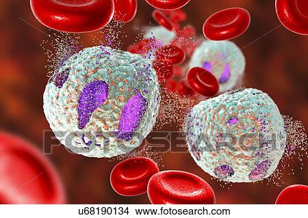 Acute lymphoblastic leukaemia treatment, illustration View Large Photo Image Picture - Acute lymphoblastic leukaemia treatment, illustration. Fotosearch