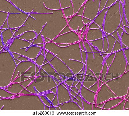 Anthrax bacteria, SEM View Large Photo Image Stock Image - Anthrax bacteria, SEM. Fotosearch