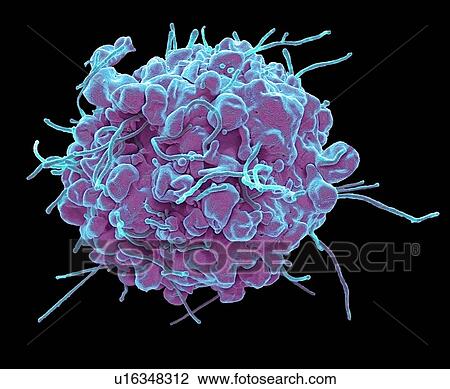 Apoptosis. Coloured scanning electron micrograph (SEM) of a 293T cell in the early stages of programmed cell death, or apoptosis. Apoptosis occurs when a cell becomes old or damaged. The cell becomes spherical as its cytoskeleton, which holds cell... View Large Photo Image Stock Image - Apoptosis. Coloured scanning electron micrograph (SEM) of a 293T cell in the early stages of programmed cell death, or apoptosis. Apoptosis occurs when a cell becomes old or damaged. The cell becomes spherical as its cytoskeleton, which holds cell.... Fotosearch