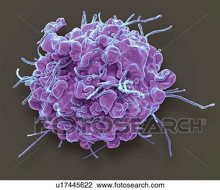 Stock Image - Apoptosis. Coloured scanning electron micrograph (SEM) of a 293T cell in the early stages of programmed cell death, or apoptosis. Apoptosis occurs when a cell becomes old or damaged. The cell becomes spherical as its cytoskeleton, which holds cell.... Fotosearch