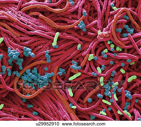 Bacteria found on mobile phone. Coloured scanning electron micrograph (SEM) of bacteria cultured from a mobile phone. Tests have revealed the average handset carries 18 times more potentially harmful germs than a flush handle in a men's toilet. With... View Large Photo Image Stock Image - Bacteria found on mobile phone. Coloured scanning electron micrograph (SEM) of bacteria cultured from a mobile phone. Tests have revealed the average handset carries 18 times more potentially harmful germs than a flush handle in a men's toilet. With.... Fotosearch