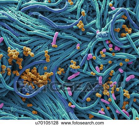 Bacteria found on mobile phone. Coloured scanning electron micrograph (SEM) of bacteria cultured from a mobile phone. Tests have revealed the average handset carries 18 times more potentially harmful germs than a flush handle in a men's toilet. With... View Large Photo Image Stock Photo - Bacteria found on mobile phone. Coloured scanning electron micrograph (SEM) of bacteria cultured from a mobile phone. Tests have revealed the average handset carries 18 times more potentially harmful germs than a flush handle in a men's toilet. With.... Fotosearch
