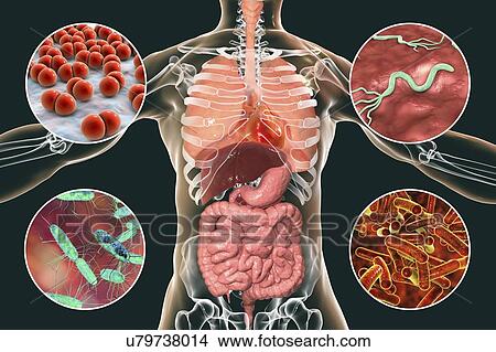 Bacteria that cause human infections, illustration View Large Photo Image Picture - Bacteria that cause human infections, illustration. Fotosearch