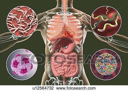 Bacteria that cause human infections, illustration View Large Photo Image Stock Image - Bacteria that cause human infections, illustration. Fotosearch