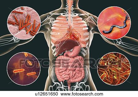 Stock Image - Bacteria that cause human infections, illustration. Fotosearch