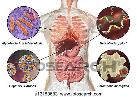 Stock Image - Bacteria that cause human infections, illustration. Fotosearch