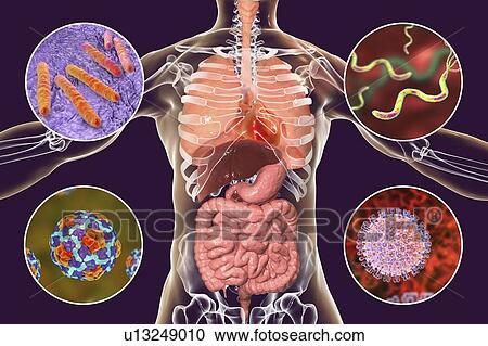 Stock Image - Bacteria that cause human infections, illustration. Fotosearch