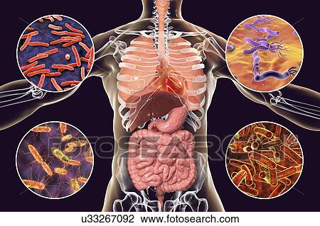 Stock Image - Bacteria that cause human infections, illustration. Fotosearch