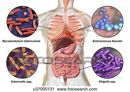 Stock Image - Bacteria that cause human infections, illustration. Fotosearch