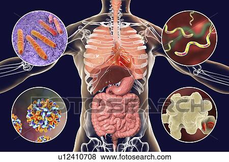 Stock Photo - Bacteria that cause human infections, illustration. Fotosearch