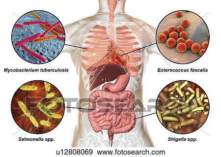 Stock Photo - Bacteria that cause human infections, illustration. Fotosearch
