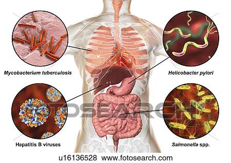 Bacteria that cause human infections, illustration View Large Photo Image Stock Photo - Bacteria that cause human infections, illustration. Fotosearch
