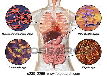 Stock Photograph - Bacteria that cause human infections, illustration. Fotosearch