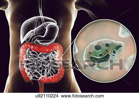 Balantidiasis, conceptual illustration View Large Photo Image Picture - Balantidiasis, conceptual illustration. Fotosearch