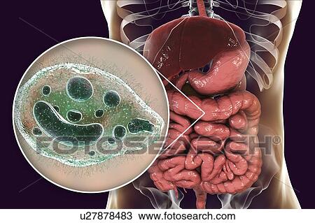 Stock Image - Balantidiasis, conceptual illustration. Fotosearch