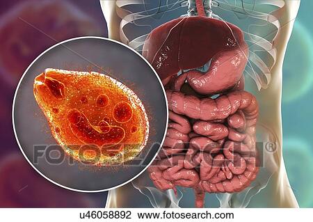 Stock Image - Balantidiasis, conceptual illustration. Fotosearch