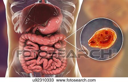 Stock Image - Balantidiasis, conceptual illustration. Fotosearch