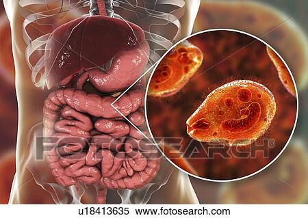 Balantidiasis, conceptual illustration View Large Photo Image Stock Photography - Balantidiasis, conceptual illustration. Fotosearch