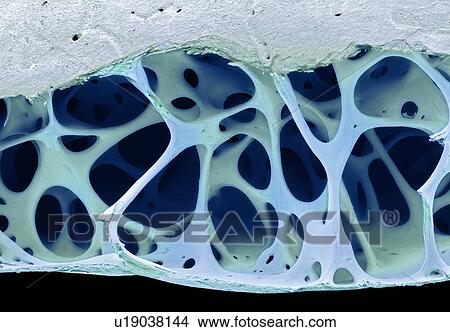 Picture - Bird bone tissue, SEM. Fotosearch