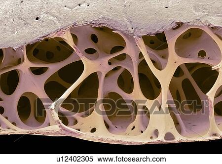 Stock Photography - Bird bone tissue, SEM. Fotosearch