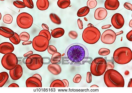 Blood after hemotransfusion for anaemia, illustration View Large Photo Image Stock Image - Blood after hemotransfusion for anaemia, illustration. Fotosearch