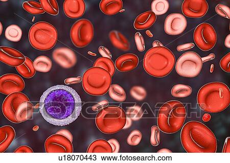 Stock Image - Blood after hemotransfusion for anaemia, illustration. Fotosearch
