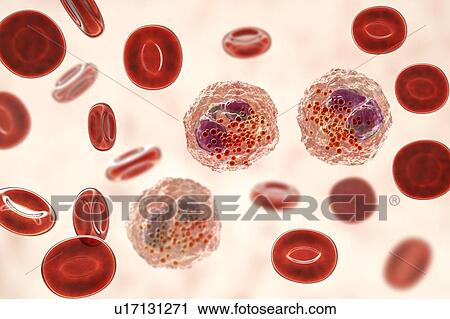 Blood smear with numerous eosinophils, illustration View Large Photo Image Stock Image - Blood smear with numerous eosinophils, illustration. Fotosearch