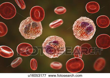 Stock Photo - Blood smear with numerous eosinophils, illustration. Fotosearch