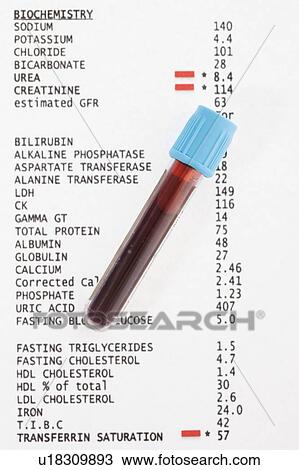 Stock Image - Blood test results with blood sample.. Fotosearch
