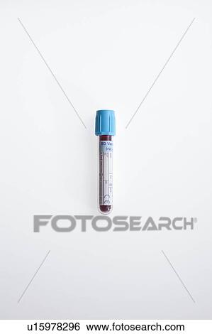 Stock Photograph - Blood test sample.. Fotosearch