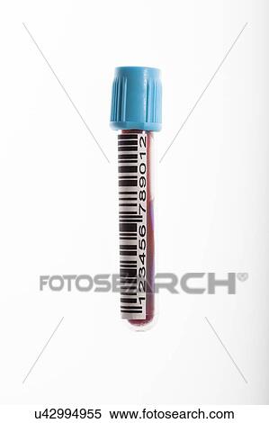 Blood test sample with barcode. View Large Photo Image Stock Photography - Blood test sample with barcode.. Fotosearch