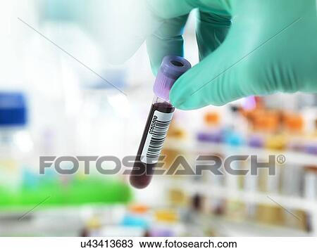 Blood test View Large Photo Image Stock Image - Blood test. Fotosearch