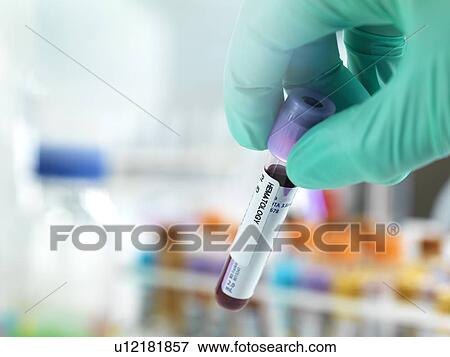 Blood test View Large Photo Image Stock Photo - Blood test. Fotosearch