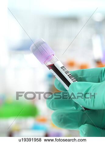 Blood test View Large Photo Image Stock Photo - Blood test. Fotosearch