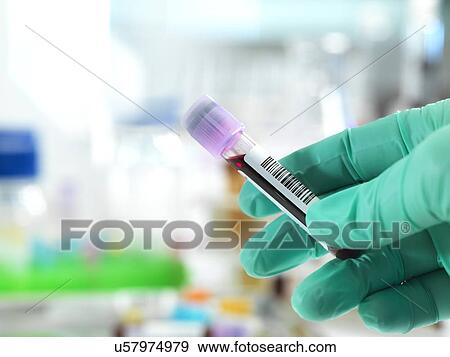 Blood test View Large Photo Image Stock Photo - Blood test. Fotosearch