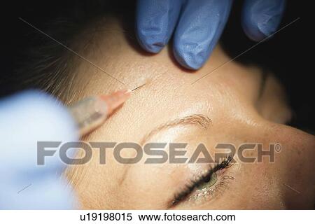 Botox treatment View Large Photo Image Stock Photography - Botox treatment. Fotosearch
