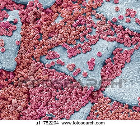 Picture - Brochosomes, Coloured scanning electron micrograph (SEM). Brochosomes are intricately structured microscopic granules secreted by leafhoppers. After each molt, leafhoppers release droplets of the brochosome-containing fluid through the anus and.... Fotosearch