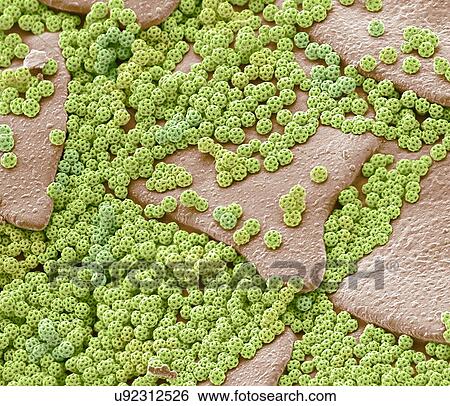 Brochosomes, Coloured scanning electron micrograph (SEM). Brochosomes are intricately structured microscopic granules secreted by leafhoppers. After each molt, leafhoppers release droplets of the brochosome-containing fluid through the anus and... View Large Photo Image Stock Photograph - Brochosomes, Coloured scanning electron micrograph (SEM). Brochosomes are intricately structured microscopic granules secreted by leafhoppers. After each molt, leafhoppers release droplets of the brochosome-containing fluid through the anus and.... Fotosearch