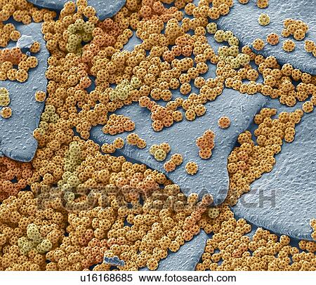 Stock Photography - Brochosomes, Coloured scanning electron micrograph (SEM). Brochosomes are intricately structured microscopic granules secreted by leafhoppers. After each molt, leafhoppers release droplets of the brochosome-containing fluid through the anus and.... Fotosearch