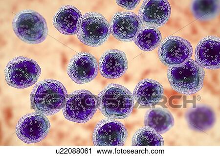 Stock Image - Burkitt's lymphoma cells, illustration. Fotosearch