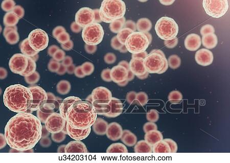 Cancer cells, illustration View Large Photo Image Picture - Cancer cells, illustration. Fotosearch