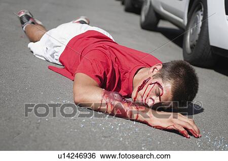 Car accident victim on the street View Large Photo Image Stock Photograph - Car accident victim on the street. Fotosearch
