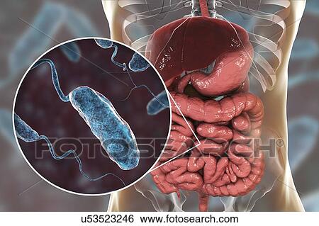 Cholera infection, illustration View Large Photo Image Stock Photograph - Cholera infection, illustration. Fotosearch