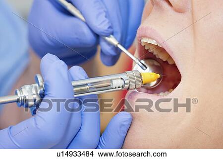 Dental Anaesthesia View Large Photo Image Picture - Dental Anaesthesia. Fotosearch