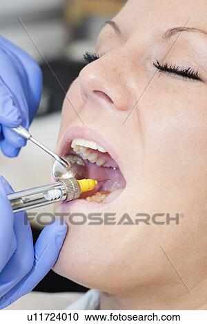 Dental anaesthesia View Large Photo Image Stock Image - Dental anaesthesia. Fotosearch